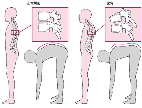 成都京研强直性脊柱炎医院